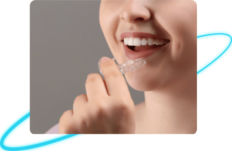 Bruxism Guard in Whittier