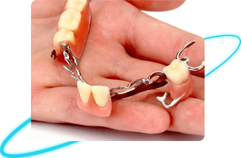 Teeth crowns & Bridges service in Whittier OR Teeth crowns & Bridges treatment in Whittier