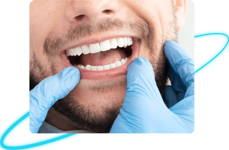Dental Bonding in Whittier
