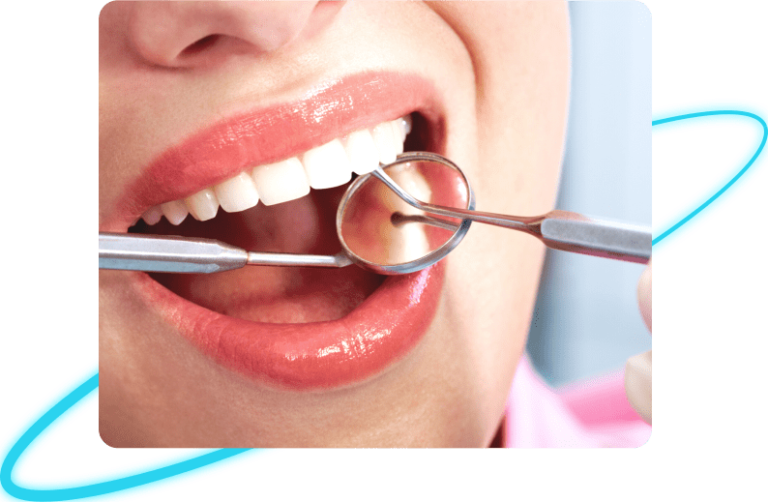 Dental Fillings in Whittier
